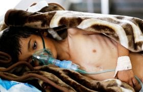yemen-cholera-middleeasteye.net-brigthened